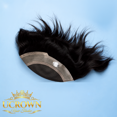 Hair Patch Services