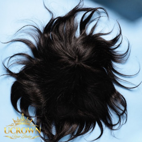 Hair Patch Services