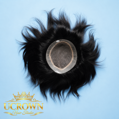 Hair Patch Services