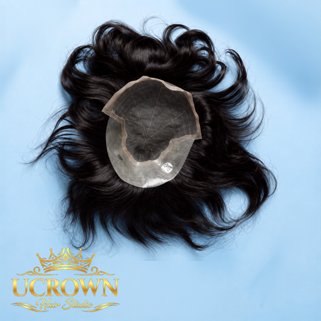 Hair Patch Services