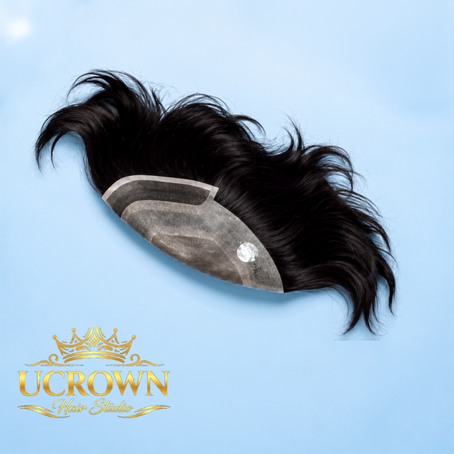 Hair Patch Services
